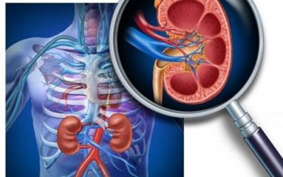 Viêm cầu thận có thể gây suy tim